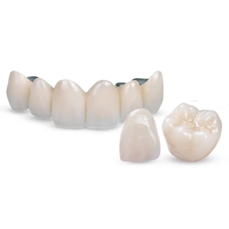 Non Removable prosthesis