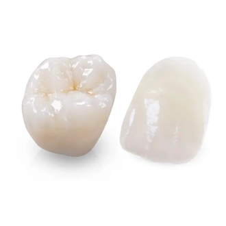 Non Removable prosthesis