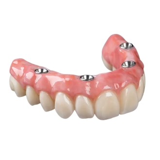 Removable prosthesis